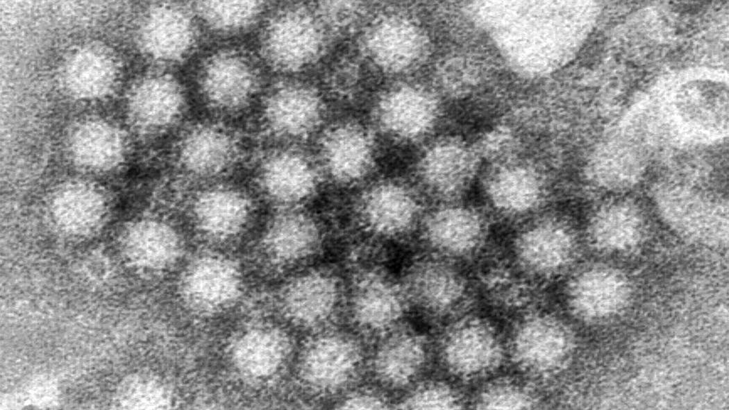 Norovirus Outbreak