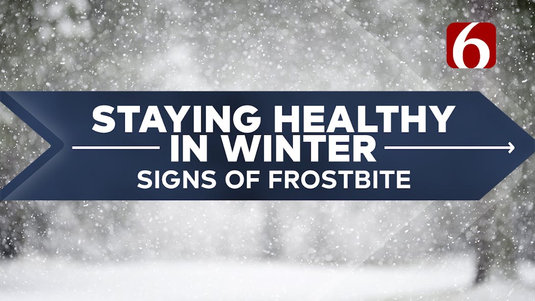 staying healthy 