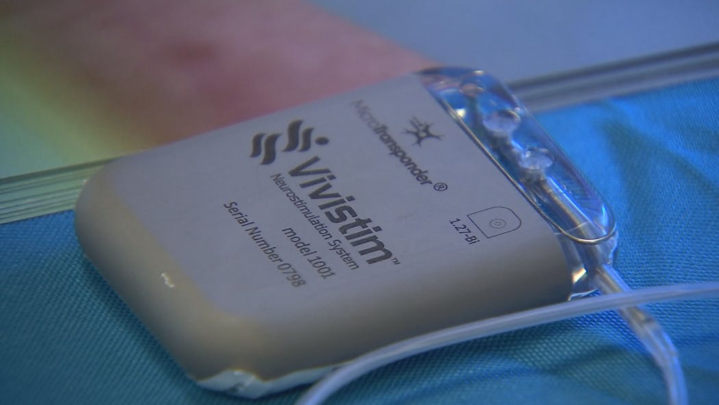 Vivistim DEVICE