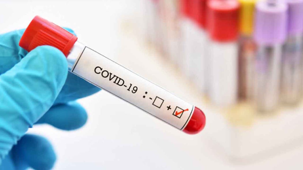 COVID Coronavirus Generic
