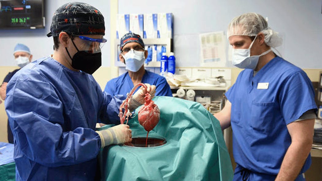 Pasien Penerima Transplantasi Jantung Babi Meninggal Usai 2 Bulan Bertahan Hidup