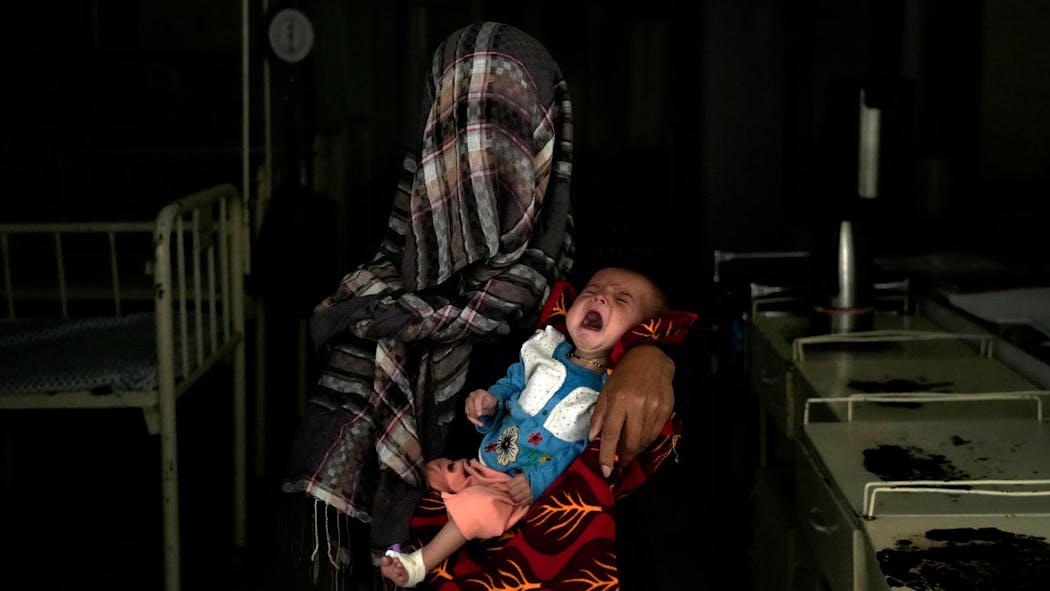 Afghan Malnutrition - AP